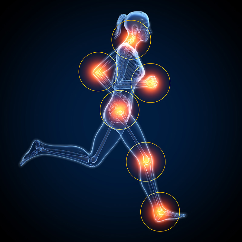 Arthrose-Beschwerden erfolgreich behandelt in der Physiotherapie Tschopp und Hilfiker in Brig-Glis